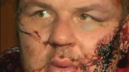 Булатов не может участвовать в следственных действиях по состоянию здоровья