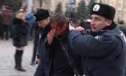 Избитый писатель Сергей Жадан: "Нельзя сломать того, кто не боится"