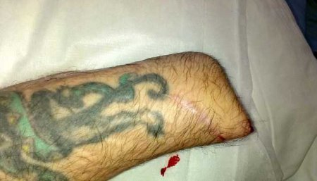 Байкер отрубил себе руку с помощью самодельной гильотины (ФОТО)