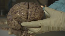 Ученые установили «срок годности» человеческого мозга