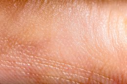Человеческая кожа, выращенная в лаборатории, может заменить кожу животных