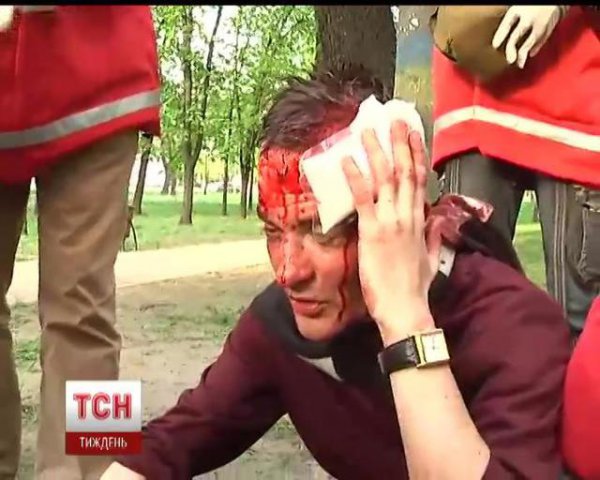 Пострадавшие в Харькове (ФОТО+ВИДЕО)