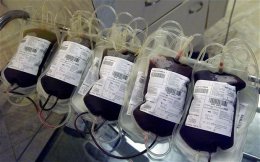 Переливание молодой крови способно «перезагрузить» организм