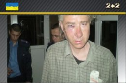 На Одесчине журналиста жестоко наказали за нелюбовь к Путину (ВИДЕО)