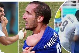 Психолог рассказал, почему уругвайский футболист укусил своего соперника