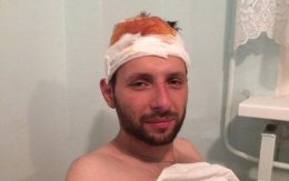 Владимир Парасюк с ранением головы лежит в больнице