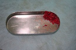 В Запорожской области предприятие вместо того, чтобы кремировать биоматериал, закапывало его в посадке