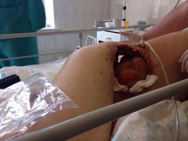 Из-за "отсутствия доказательств участия в АТО" судья лишил права голоса пограничника (ФОТО)