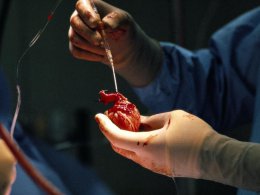 Медики нашли новый источник донорского материала для пересадки сердца