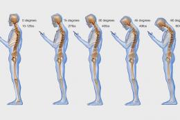 Смартфоны могут привести к искривлению позвоночника, - медики