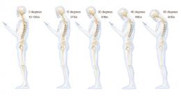 Медики установили, что смартфоны вредны для позвоночника