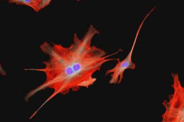 Шведские ученые создали искусственную нервную клетку