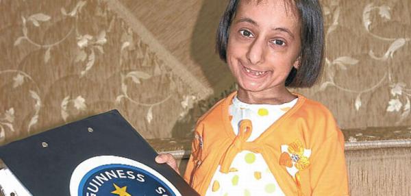 Самая маленькая женщина в мире из Турции (ФОТО)