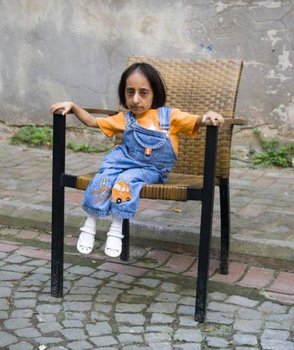 Самая маленькая женщина в мире из Турции (ФОТО)