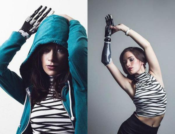 Девушка с протезом покорила мир моды (ФОТО)