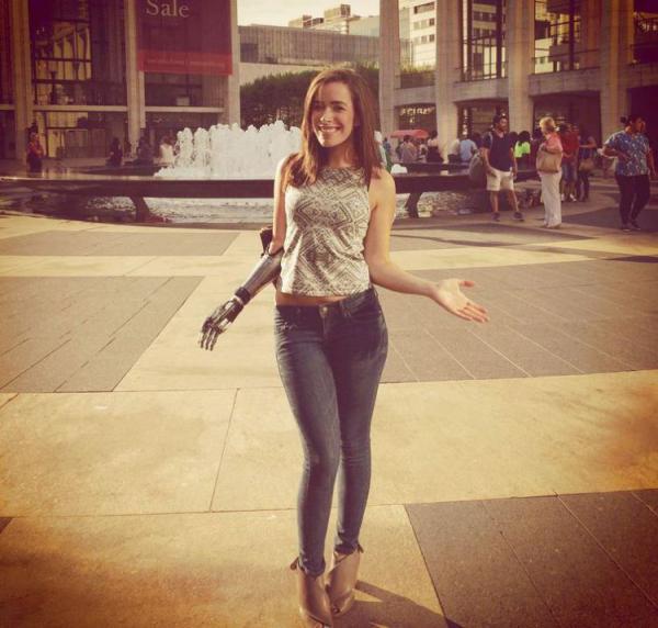 Девушка с протезом покорила мир моды (ФОТО)