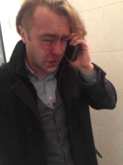 "Свободовец" Игорь Мирошниченко показал последствия своего избиения (ФОТО)