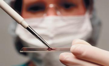 Новый анализ крови поможет в диагностике рака