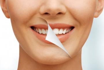 Методы профессиональной чистки зубов