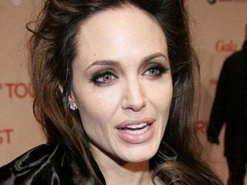«Ген Анджелины Джоли» повышает риск развития болезни Альцгеймера