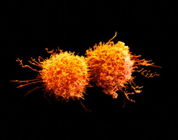 Почему бактерии и опухоли отказываются от кислорода