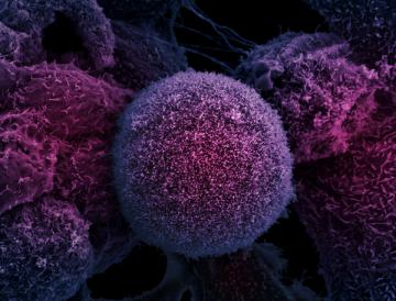 Ученые нашли дополнительный способ лечения рака