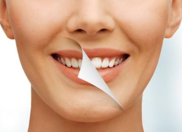 6 мифов об отбеливании зубов
