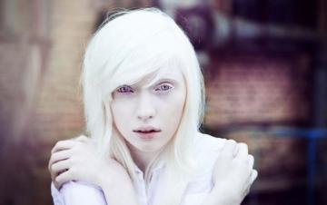 Биологи обнаружили белок, вызывающий альбинизм