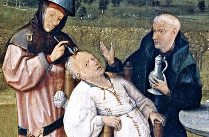 10 страшных медицинских процедур, которые используются до сих пор (ФОТО)