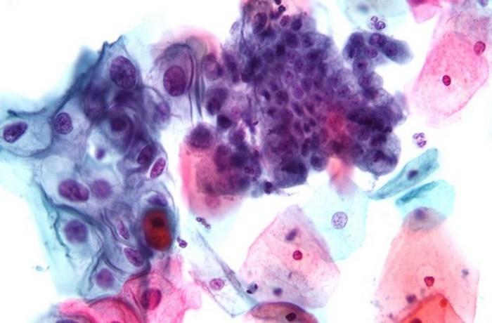 10 страшных медицинских процедур, которые используются до сих пор (ФОТО)