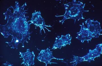 Ученые нашли нестандартные способы лечения рака