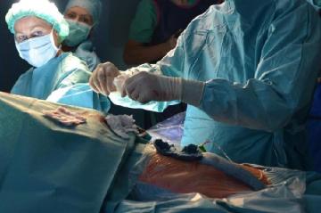 Швейцарские врачи сделали важный шаг в лечении ожогов