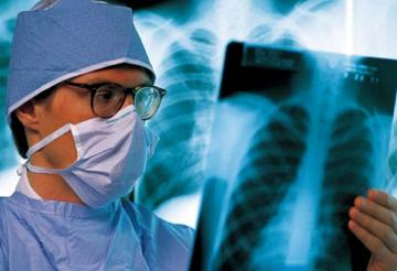 Украина вошла в топ-5 стран с высоким уровнем заболевания туберкулезом