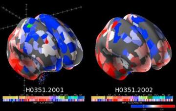 Ученые создали новую карту головного мозга человека