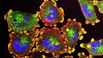 Прорыв в лечении рака - создан новый иммунотерапевтический препарат