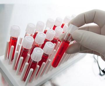 Анализ крови позволит установить риск внезапной смерти - ученые