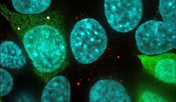 Ученые обнаружили новый элемент, влияющий на работу клеток тела