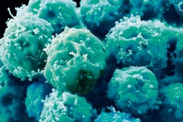 Ученые: Лечение стволовыми клетками небезопасно