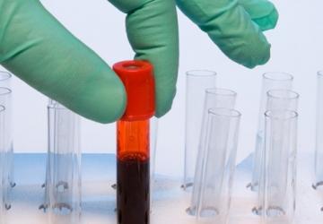 Ученые: Уровень ТМАО в крови предскажет приближающуюся смерть