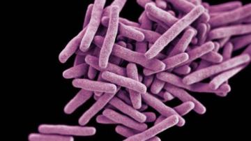 Специалисты объяснили, почему туберкулез не стал причиной смерти всего человечества
