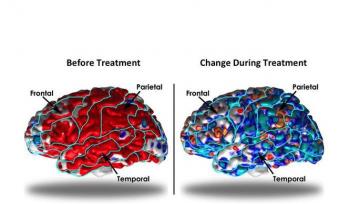 Ученые рассказали, как депрессия влияет на мозг человека