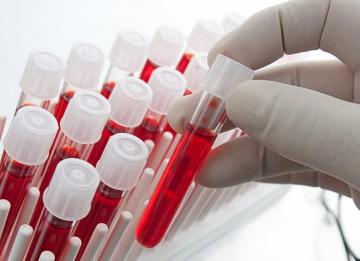 Ученые выяснили «самую сексуальную» группу крови
