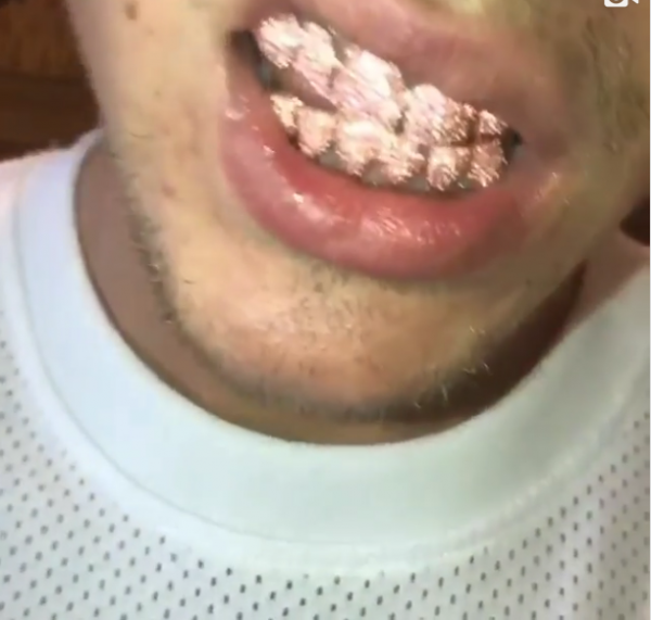 Джастин Бибер сделал себе розовые сапфировые зубы (ФОТО)