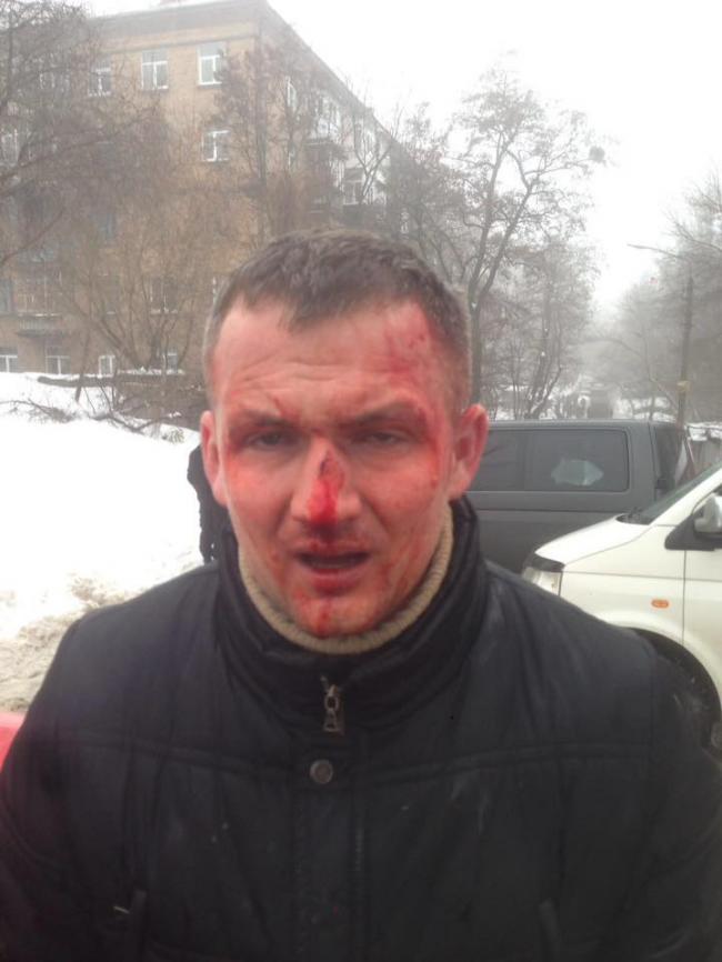 В полиции Киева рассказали о нападении на депутата Верховной Рады (ФОТО)