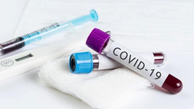 В Украине третий день подряд сокращается число новых случаев коронавируса