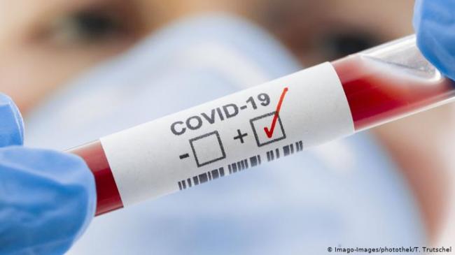 Обнаружено вещество на 70% облегчающее течение болезни при заражении COVID-19
