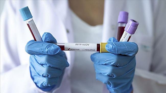 В Украине зафиксировали 4 647 новых случаев коронавируса
